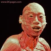 This specimen demystifies the nature of who we really are. Look at the complex facial muscle attachment and layering.