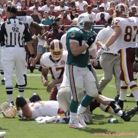 Washington Redskins vs Miami Dolphins